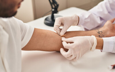 Testosterone Test: How to Test Testosterone Levels