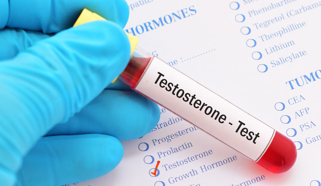 Is It Time for a Testosterone Test? Signs to Watch For