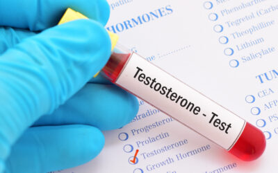 Is It Time for a Testosterone Test? Signs to Watch For