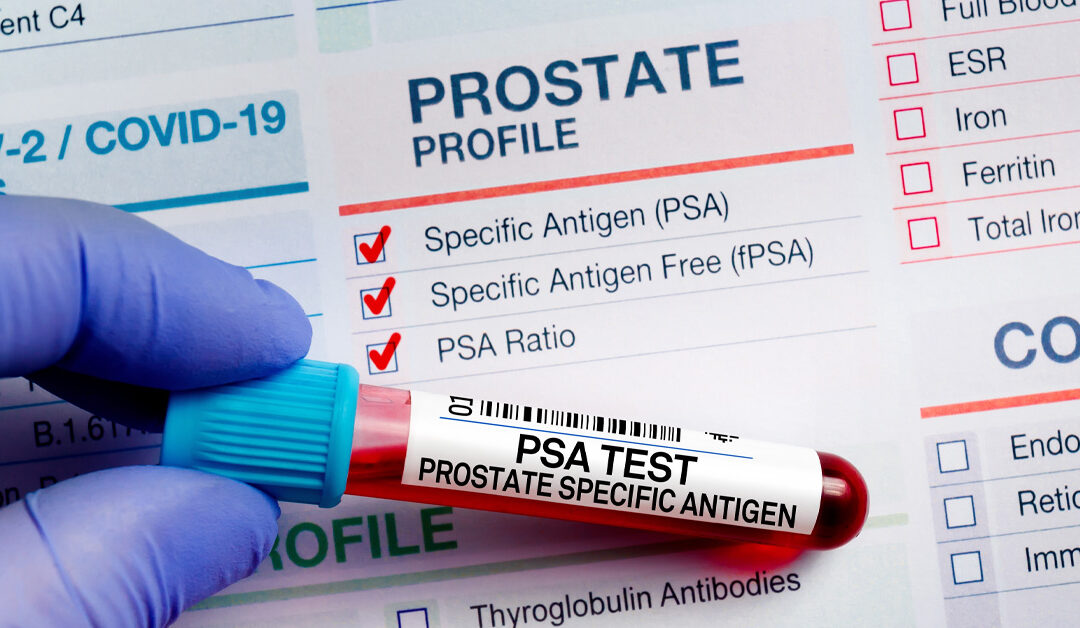 What Is a PSA Test? Understanding Prostate Screening