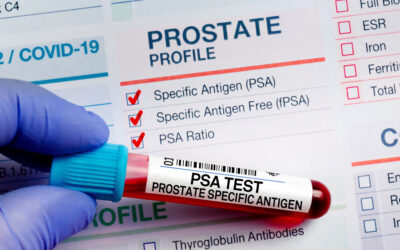 What Is a PSA Test? Understanding Prostate Screening