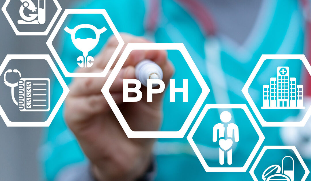 What Happens If BPH Goes Untreated? Urology FAQ
