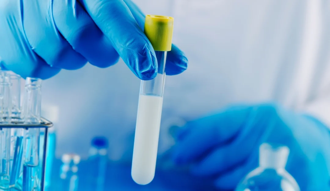 Semen Analysis Near Me: What a Semen Analysis Shows and When Men May Need One